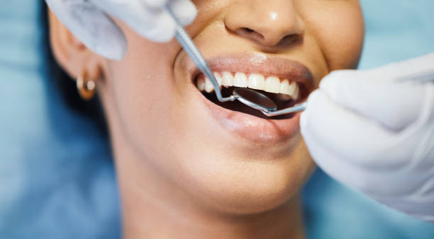 Best Emergency Treatment for Dental Infections or Abscesses in Essex Village, CT