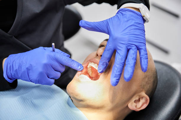 Best Emergency Treatment for Dental Infections or Abscesses in Essex Village, CT